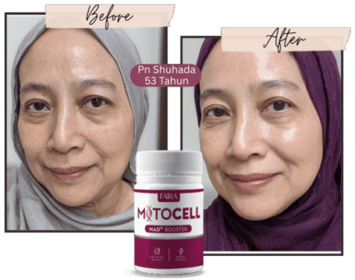 MitoCell-web-11-e1755004625983-600x474.png