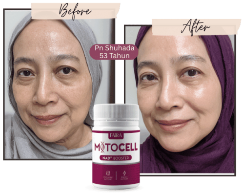 MitoCell-web-11-e1755004625983.png